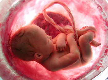 Gynaecology hospitals in Haryana,Best gynaecology hospitals in Haryana,Best Obstetrics and gynaecology hospitals in Haryana,Best Obstetrics and gynaecology doctors in Haryana,gynaecology treatments in Haryana,best Gynaecologists in Haryana,Best obstetric specialist in Haryana,High pregnancy risk specialists in Haryana,polycyst Ovarian Disease treatments in Haryana,Prenatal and Antepartum Care in Haryana,Best Gynaecology Caesarean hospitals in Haryana,Premature Rupture treatments in Haryana,Vaginal Infections specialist in Haryana,Gynaecology hospitals in Rohtak,Best gynaecology hospitals in Rohtak,Best Obstetrics and gynaecology hospitals in Rohtak,Best Obstetrics and gynaecology doctors in Rohtak,gynaecology treatments in Rohtak,best Gynaecologists in Rohtak,Best obstetric specialist in Rohtak,High pregnancy risk specialists in Rohtak,polycyst Ovarian Disease treatments in Rohtak,Prenatal and Antepartum Care in Rohtak,Best Gynaecology Caesarean hospitals in Rohtak,Premature Rupture treatments in Rohtak,Vaginal Infections specialist in Rohtak,Best Hospital for infertility in Haryana,Best Hospital for infertility in Rohtak