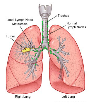 Best Pulmonologists in Haryana,Best Pulmonology Hospitals in Haryana,Best Pulmonologists in Rohtak,Best Pulmonology Hospitals in Rohtak